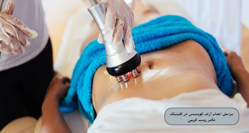 مراحل انجام آراف کویتیشن در کلینیک دکتر زینب کریمی