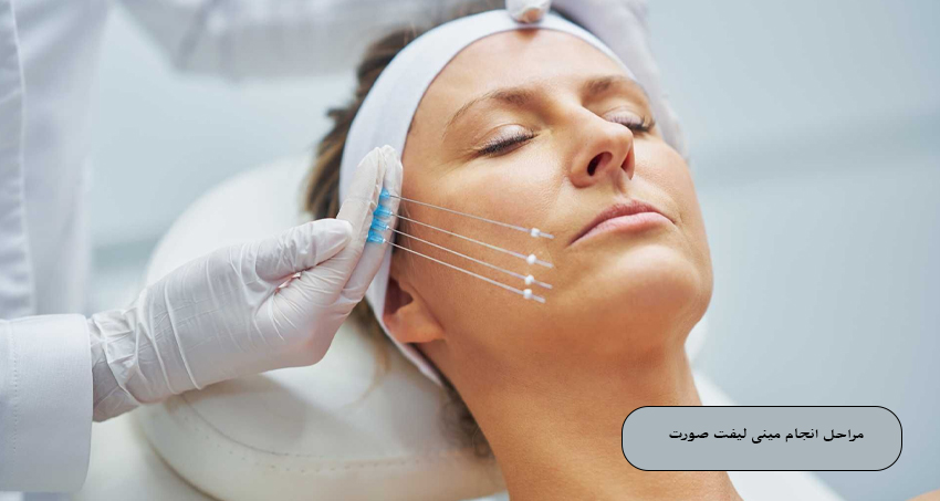 مراحل انجام مینی لیفت صورت