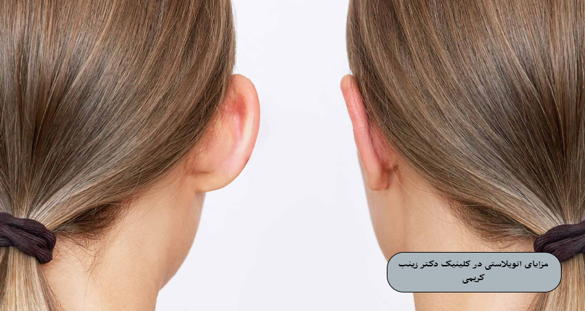 مزایای اتوپلاستی در کلینیک دکتر زینب کریمی
