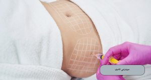 مزوتراپی لاغری