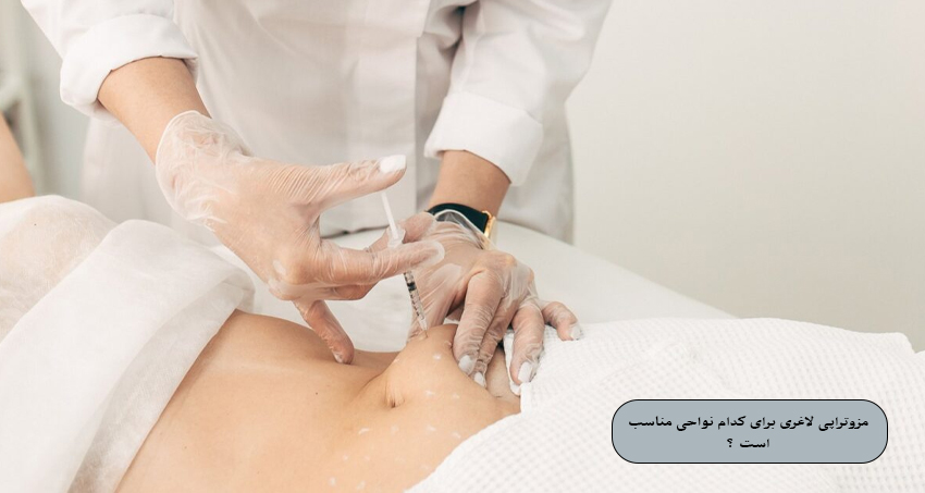 مزوتراپی لاغری برای کدام نواحی مناسب است ؟