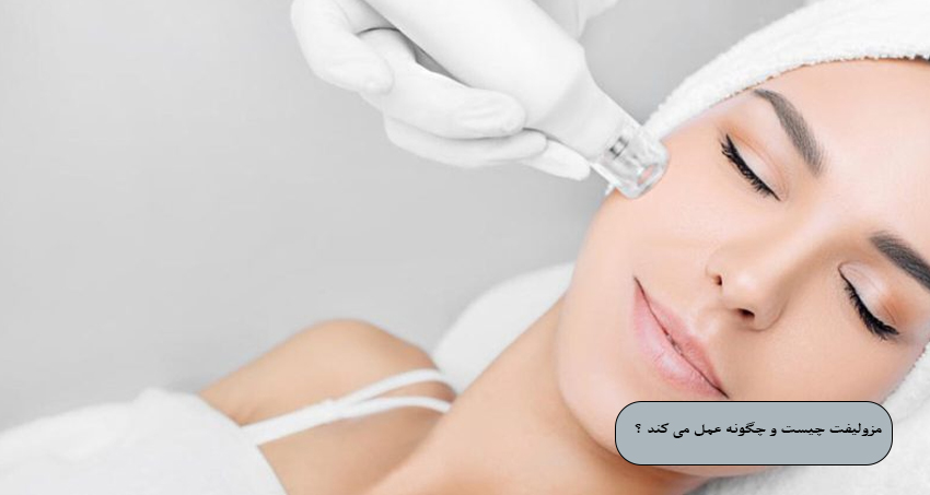 مزولیفت صورت چیست و چگونه عمل می ‌کند ؟