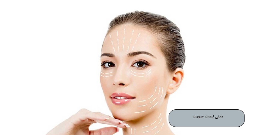مینی لیفت صورت