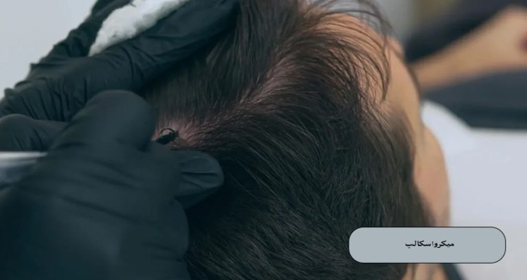 میکرواسکالپ