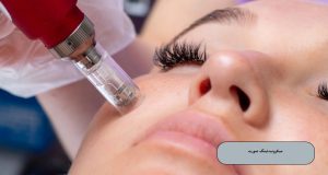 میکرونیدلینگ صورت