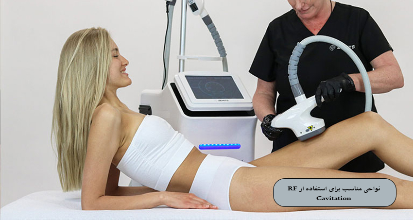 نواحی مناسب برای استفاده از RF Cavitation