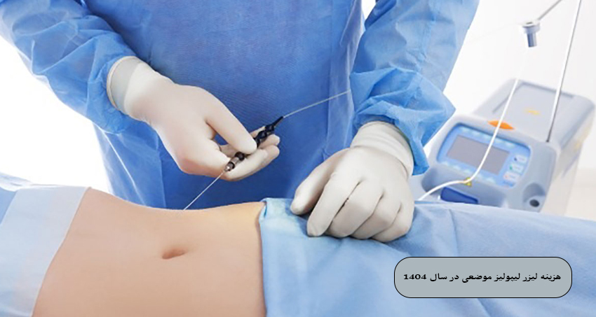 هزینه لیزر لیپولیز موضعی در سال 1404