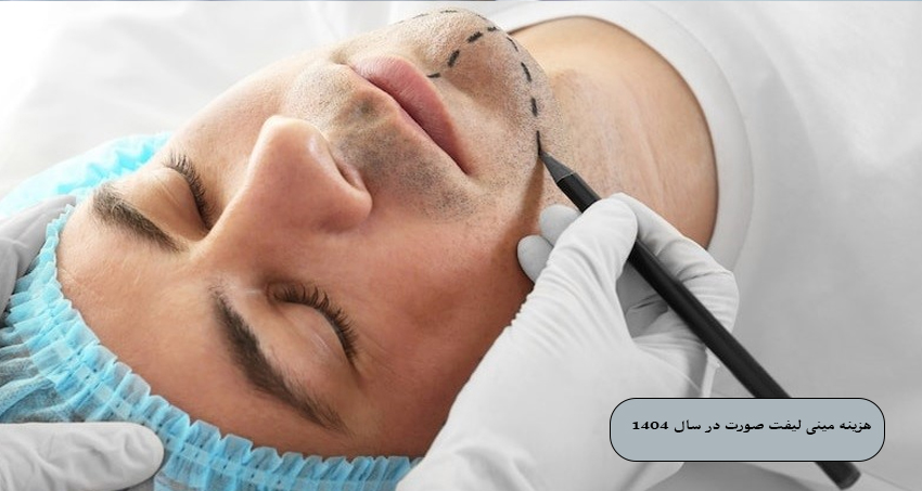 هزینه مینی لیفت صورت در سال ۲۰۲۵