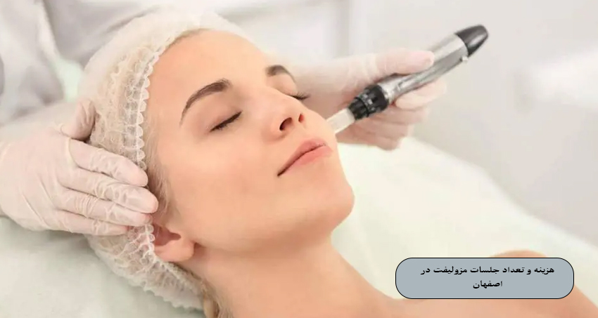 هزینه مزولیفت صورت در اصفهان