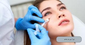 پی آر پی زیر چشم