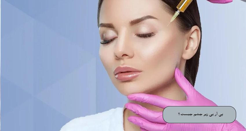 پی آر پی زیر چشم چیست؟