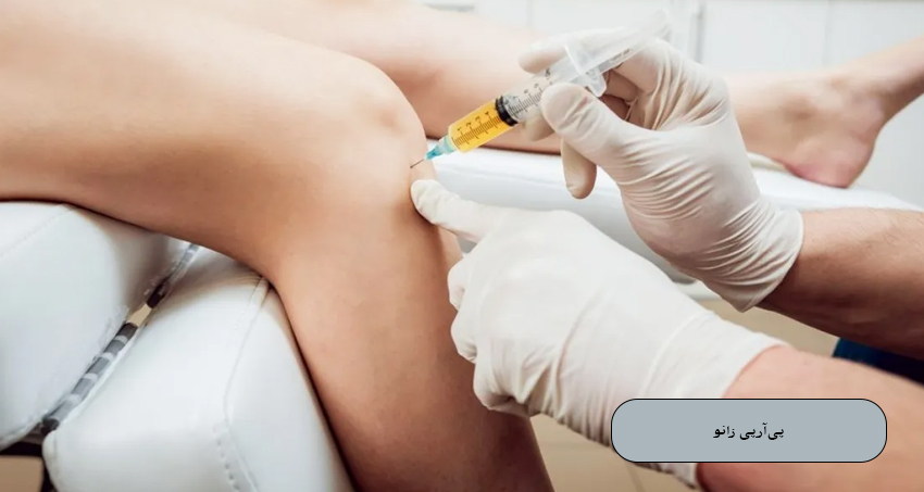 پی‌ آر‌ پی زانو