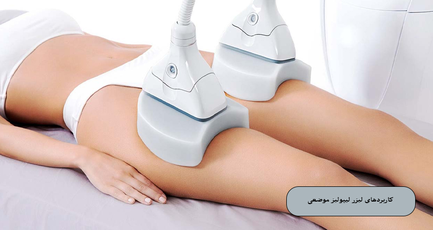 کاربردهای لیزر لیپولیز موضعی