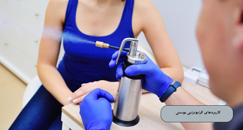 کاربردهای کرایوتراپی پوستی