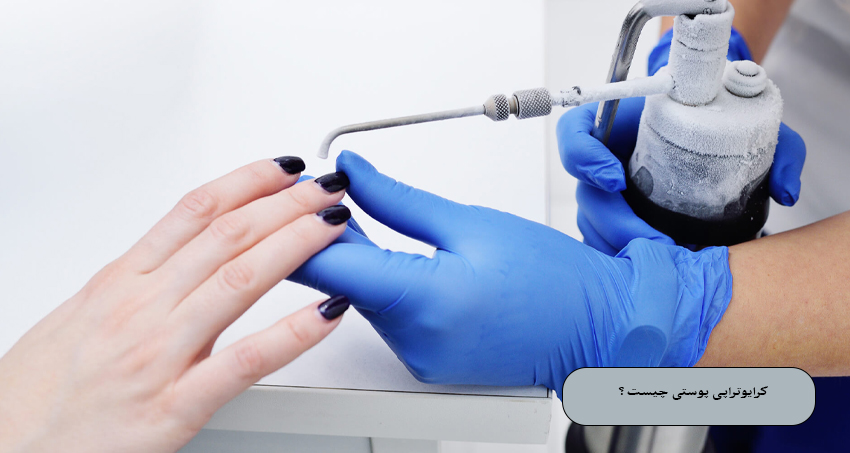 کرایوتراپی پوستی چیست؟