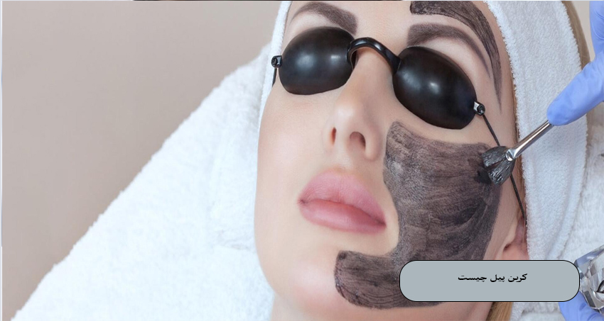 کربن پیل چیست