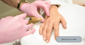 بوتاکس دست برای چروک