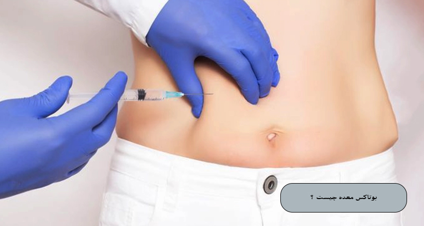 بوتاکس معده چیست؟