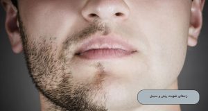 تقویت ریش و سبیل