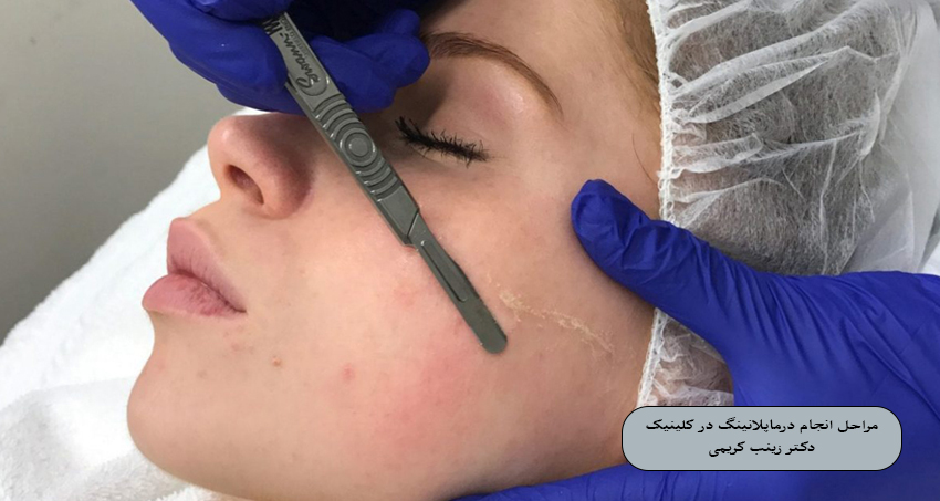 مراحل انجام درماپلنینگ در کلینیک دکتر زینب کریمی