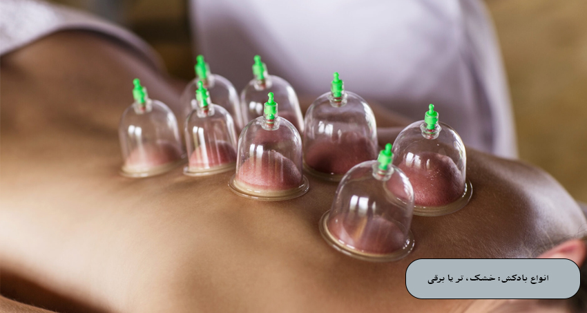 انواع بادکش: خشک، تر یا برقی؛ کدام برای شما مناسب است؟