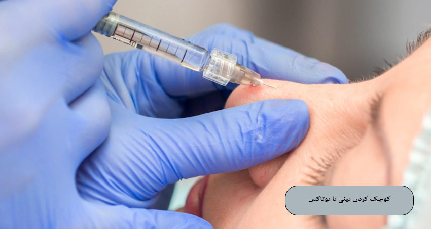 کوچک کردن بینی با بوتاکس