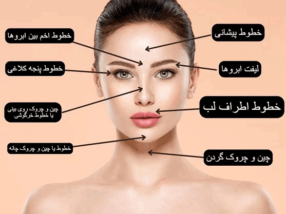 Botox